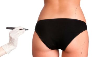 Body Lift / Contouring