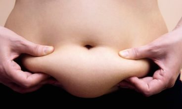 Weight Loss Surgery